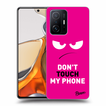 Ovitek za Xiaomi 11T Pro - Angry Eyes - Pink