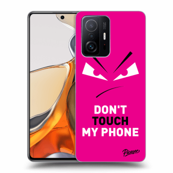 Ovitek za Xiaomi 11T Pro - Evil Eye - Pink