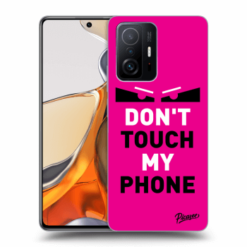 Ovitek za Xiaomi 11T Pro - Shadow Eye - Pink