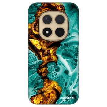 Picasee Fashion Case za Xiaomi Redmi Note 15 Pro+ - Goldsky