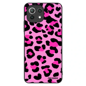 Ovitek za Xiaomi 11 Lite 5G NE - Pink Tiger