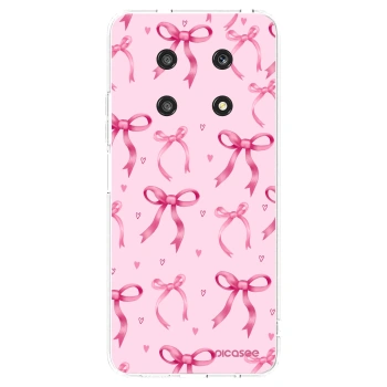 Picasee silikonski prozorni ovitek za Honor Magic4 Lite 5G - Bow Aesthetic