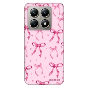Ovitek za Xiaomi 14T Pro - Bow Aesthetic