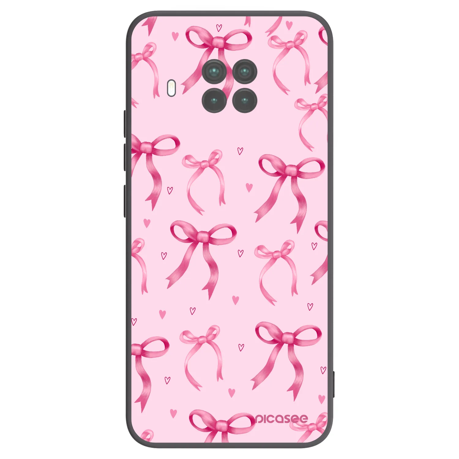 Picasee silikonski črni ovitek za Xiaomi Mi 10T Lite - Bow Aesthetic