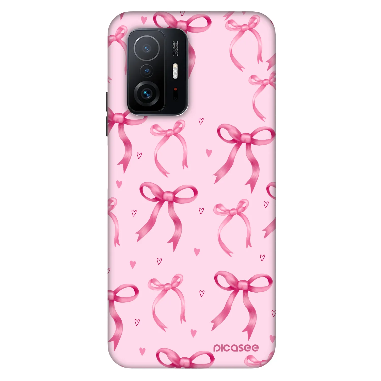 Picasee Fashion Case za Xiaomi 11T - Bow Aesthetic