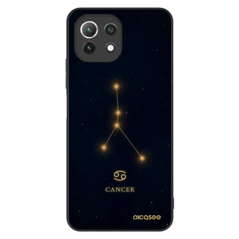 Ovitek za Xiaomi 11 Lite 5G NE - CANCER