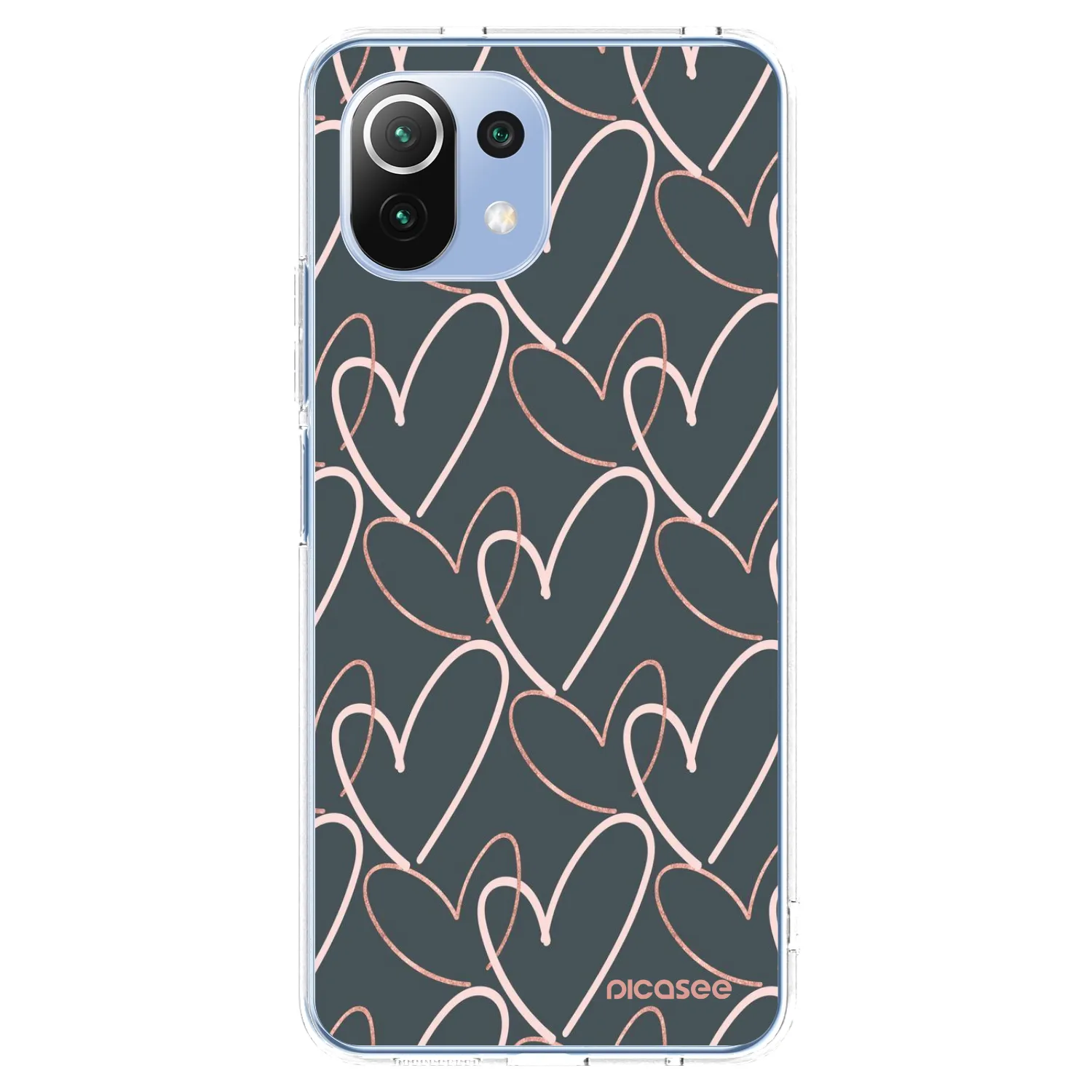 Picasee silikonski prozorni ovitek za Xiaomi Mi 11 Lite - Lots of love